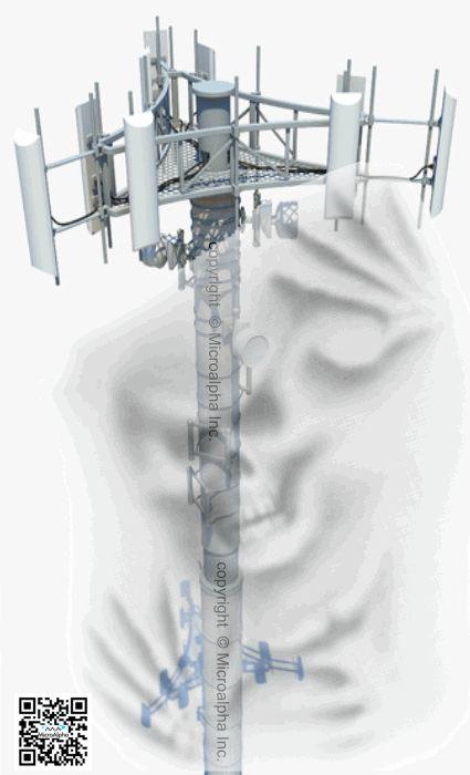 Protection against harmful EMFs coming from Cell Towers by MicroAlpha Products